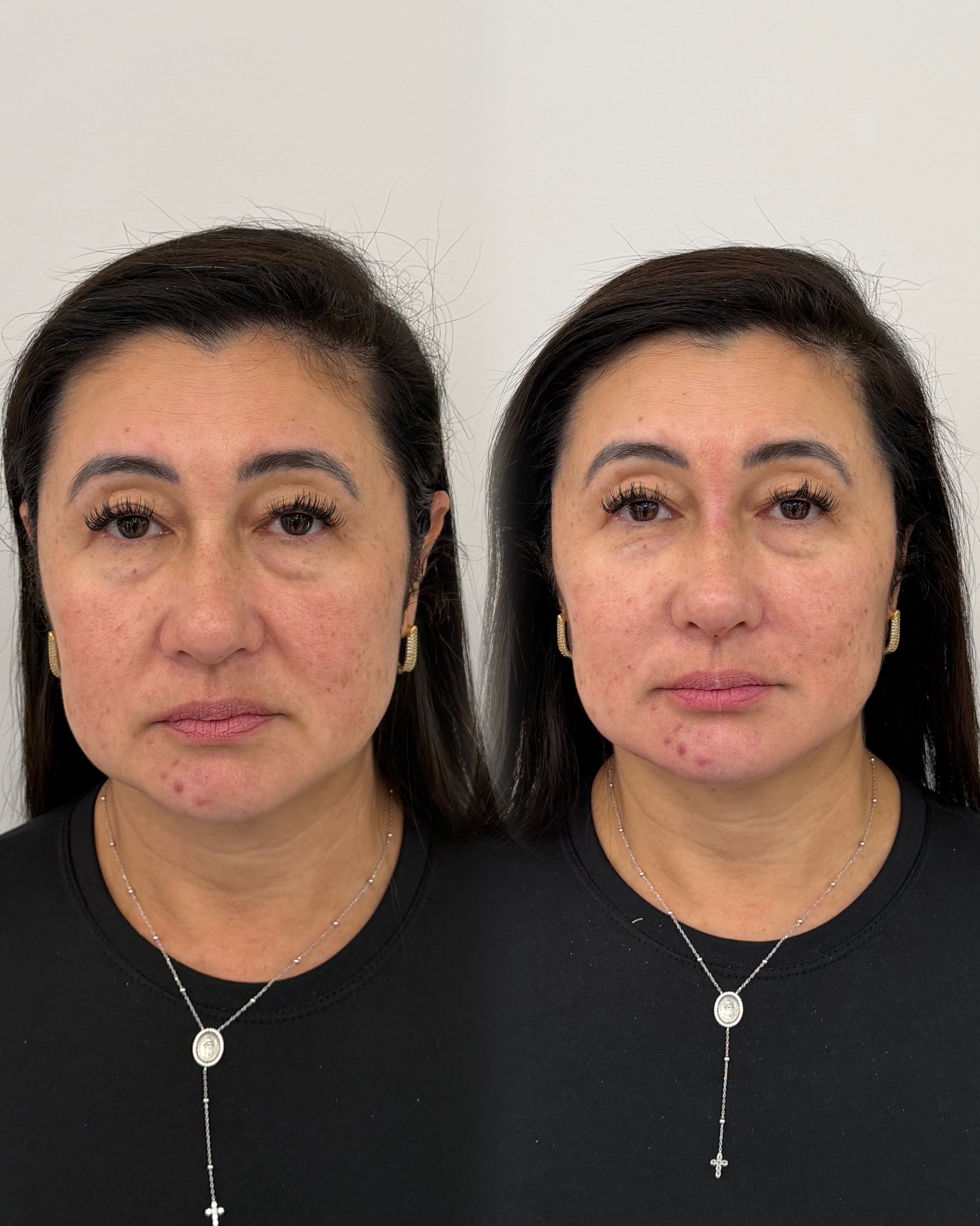 Resultado Dra. Ana Baltazar